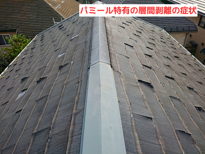 パミール特有の層間剥離の症状