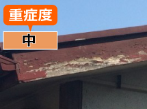 重症度：中
